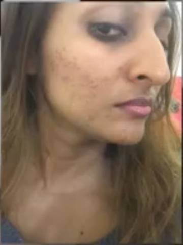 Desi Girl With Clear Face